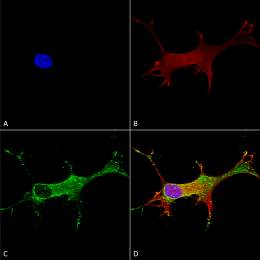 Anti Notch Antibody Qed Bioscience Inc