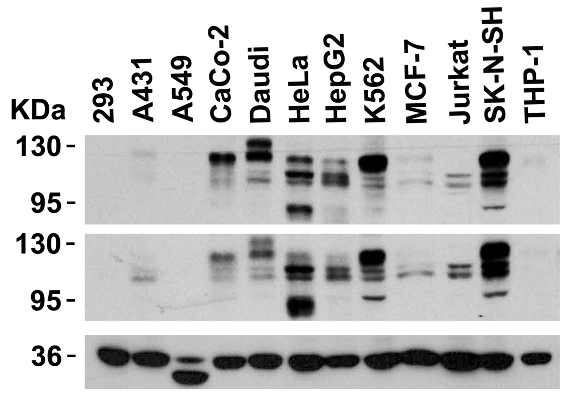 Anti TACE ADAM17 Antibody QED Bioscience Inc