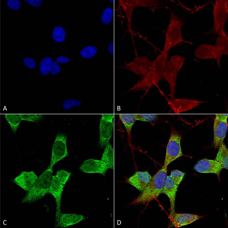 Anti Task Potassium Channel Antibody Qed Bioscience Inc