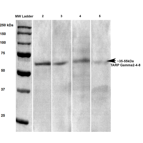 Anti TARPγ2 4 8Stargazin Antibody QED Bioscience Inc